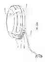 Fig. 280 - Infusion pump assembly