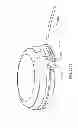 Fig. 281 - Infusion pump assembly