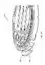 Fig. 282 - Infusion pump assembly