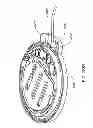 Fig. 285 - Infusion pump assembly
