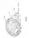 Fig. 286 - Infusion pump assembly