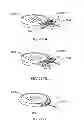 Fig. 289 - Infusion pump assembly