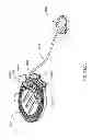 Fig. 296 - Infusion pump assembly