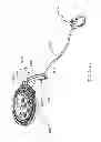 Fig. 308 - Infusion pump assembly