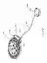 Fig. 312 - Infusion pump assembly