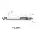 Fig. 314 - Infusion pump assembly