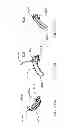 Fig. 315 - Infusion pump assembly