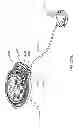 Fig. 321 - Infusion pump assembly