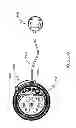 Fig. 323 - Infusion pump assembly