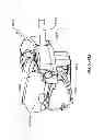 Fig. 327 - Infusion pump assembly