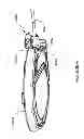 Fig. 328 - Infusion pump assembly