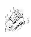 Fig. 330 - Infusion pump assembly