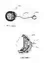 Fig. 338 - Infusion pump assembly