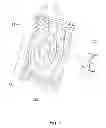 Fig. 05 - Ultrathin electromagnetic vibration device and its manufacturing method