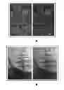 Fig. 01 - Binocular visual experience enrichment system