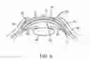 Fig. 04 - Contact lens with a hydrophilic layer