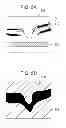 Fig. 06 - Image processing apparatus and image processing method for displaying indexes for different forms in a region of a retinal pigment epithelium