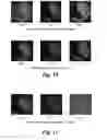 Fig. 09 - OPEN TOP MICROFLUIDIC DEVICE FOR MULTIPLEXING