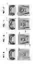 Fig. 07 - Fastener systems that provide EME protection