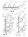 Fig. 09 - Directional front illuminating device comprising a film based lightguide with high optical clarity in the light emitting region