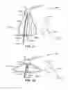 Fig. 11 - Directional front illuminating device comprising a film based lightguide with high optical clarity in the light emitting region