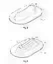 Fig. 04 - COMPOSITE X-RAY TRANSMISSIVE WINDOWS