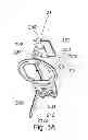 Fig. 06 - Dental positioning system