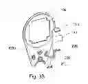 Fig. 07 - Dental positioning system