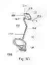 Fig. 09 - Dental positioning system