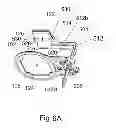 Fig. 16 - Dental positioning system