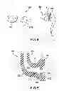 Fig. 06 - High retention aural transmission device