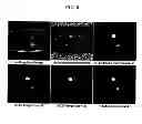 Fig. 09 - Method and apparatus for accelerated phase contrast magnetic resonance angiography and blood flow imaging