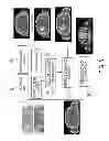 Fig. 06 - Generating attenuation correction maps for combined modality imaging studies and improving generated attenuation correction maps using MLAA and DCC algorithms