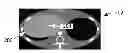 Fig. 01 - Multi-energy imaging