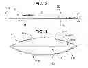 Fig. 03 - BAG