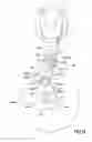Fig. 09 - Dual scara arm