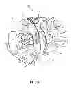 Fig. 02 - Process for salvaging turbocharger compressor housings