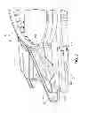 Fig. 03 - FAN SHROUD WITH COMPLEMENTARY TWO-SIDED RIBBING