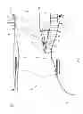 Fig. 02 - Mounting lug for connecting a vane to a turbine engine case