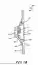 Fig. 04 - Inlet shroud assembly