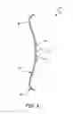 Fig. 05 - Inlet shroud assembly