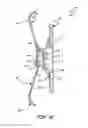 Fig. 08 - Inlet shroud assembly