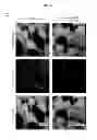 Fig. 12 - Imaging beta cell mass