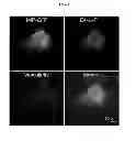 Fig. 13 - Imaging beta cell mass