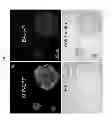 Fig. 15 - Imaging beta cell mass