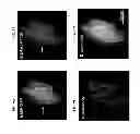Fig. 16 - Imaging beta cell mass