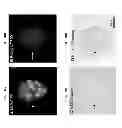 Fig. 18 - Imaging beta cell mass