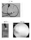 Fig. 23 - Imaging beta cell mass