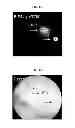 Fig. 24 - Imaging beta cell mass