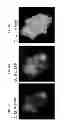 Fig. 29 - Imaging beta cell mass
